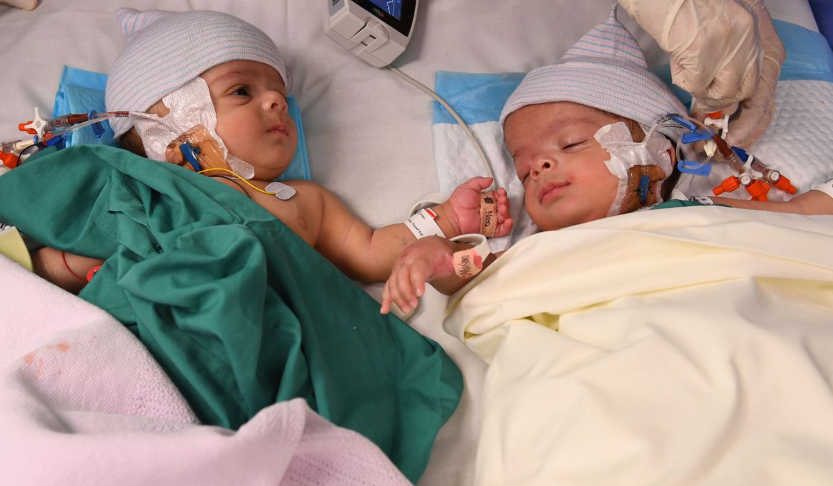 Yemeni twins